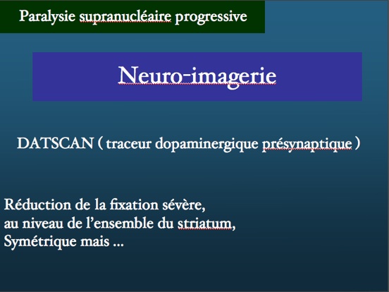 neuroimageriedatscanpsp.jpg